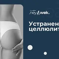 Устранение целлюлита