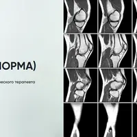 Магнитно-резонансная томография (норма)