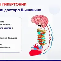 Система лечения гипертонии