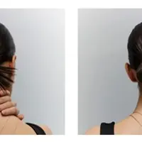 Кожа и волосы