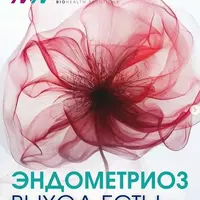 Эндометриоз. Выход есть