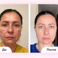 Код молодости