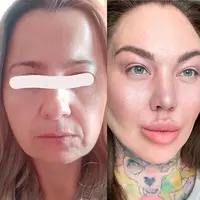 Антиэйдж в большом городе