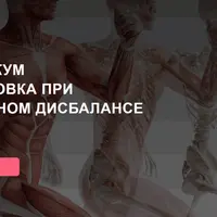 Тренировка при мышечном дисбалансе