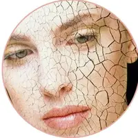 Как реанимировать мелкоморщинистую кожу