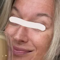 Против пигментации: рационы, уход, добавки, косметика