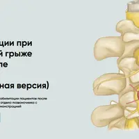 Протокол реабилитации при поясничной грыже диска после операции