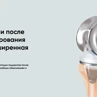 Протокол реабилитации после эндопротезирования колена