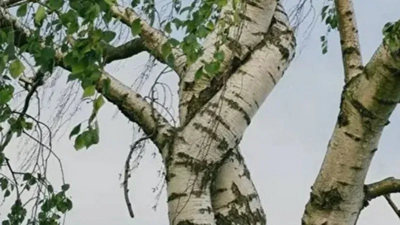 Дисплазия соединительной ткани