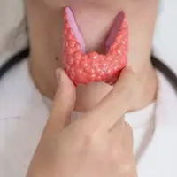 Щитовидная железа. Новое в терапии. Определяем и устраняем проблемы с щитовидкой