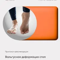 Вальгусная деформация стоп