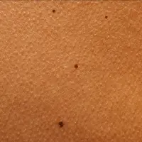 Кожный покров